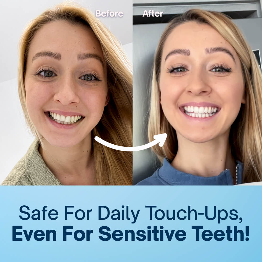 Precision Teeth Whitening Pen