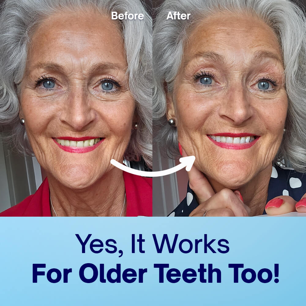 Dentist-Approved Teeth Whitening Powder